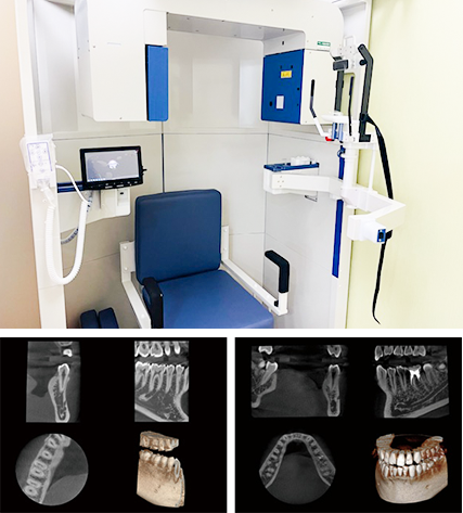 歯科用CT
