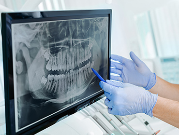 治療計画の共有