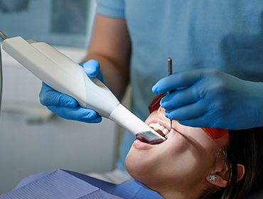 口腔内スキャナーによる型取り