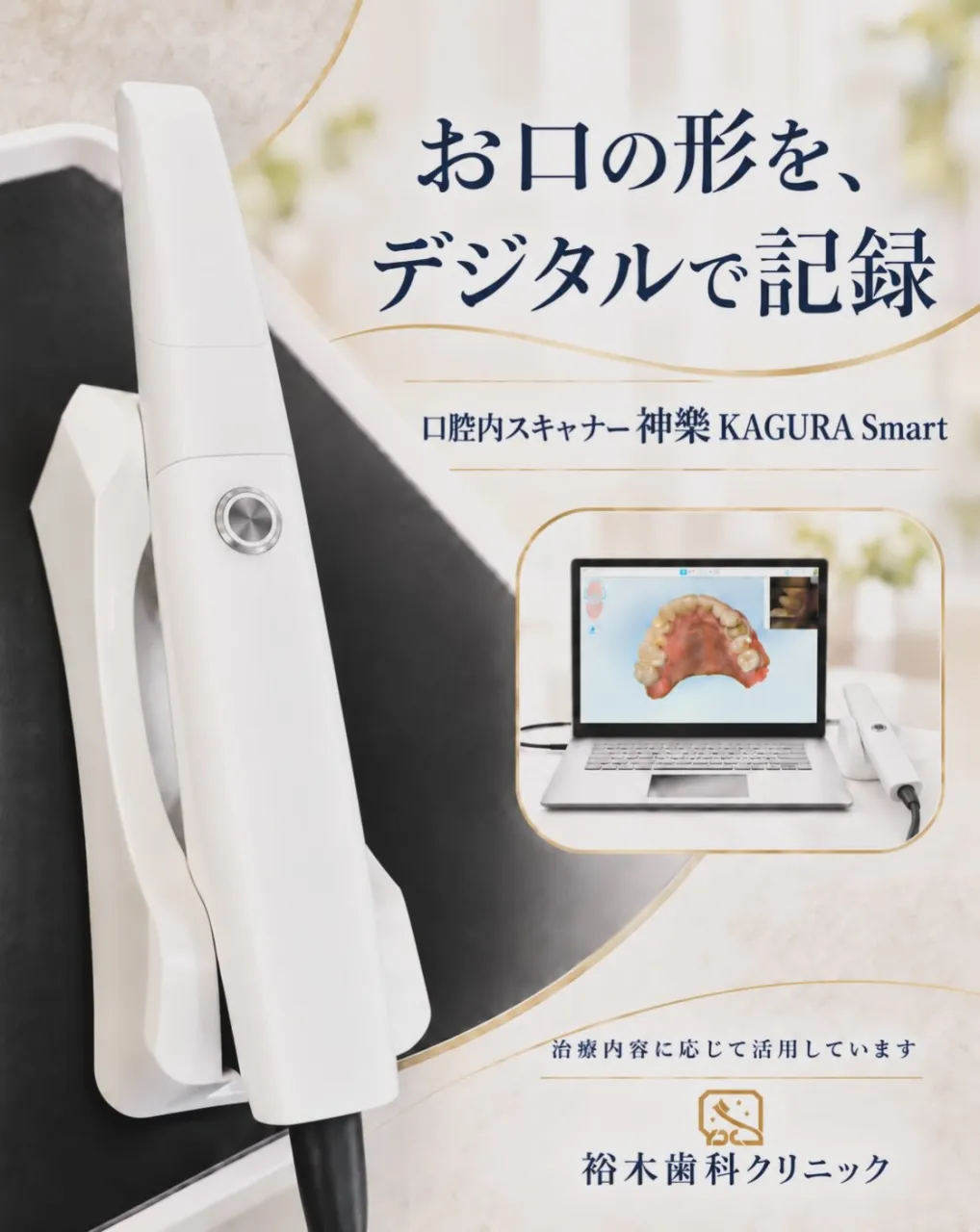 🦷 口腔内スキャナー「神樂 KAGURA Smart」をご紹...
